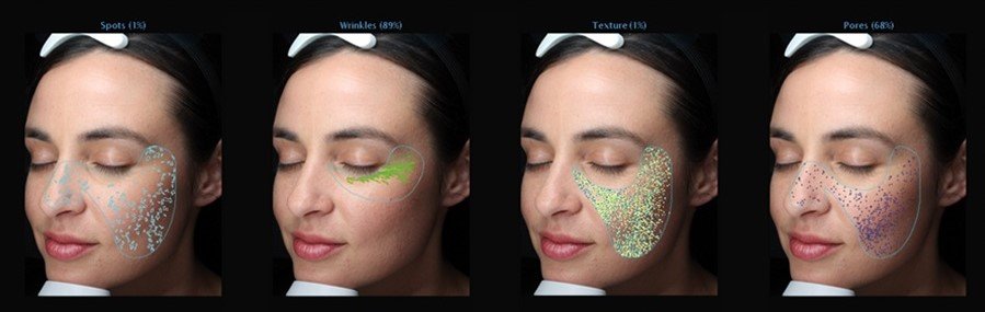 VISIA-Skin-Analysis-Main-Photo-3_left